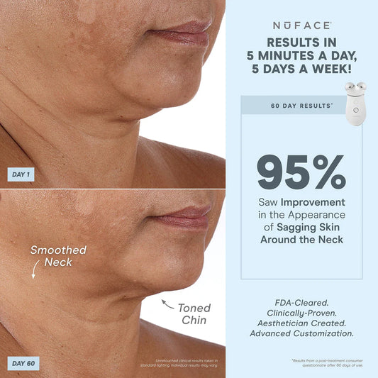 Nuface - Complete advanced facial toning kit