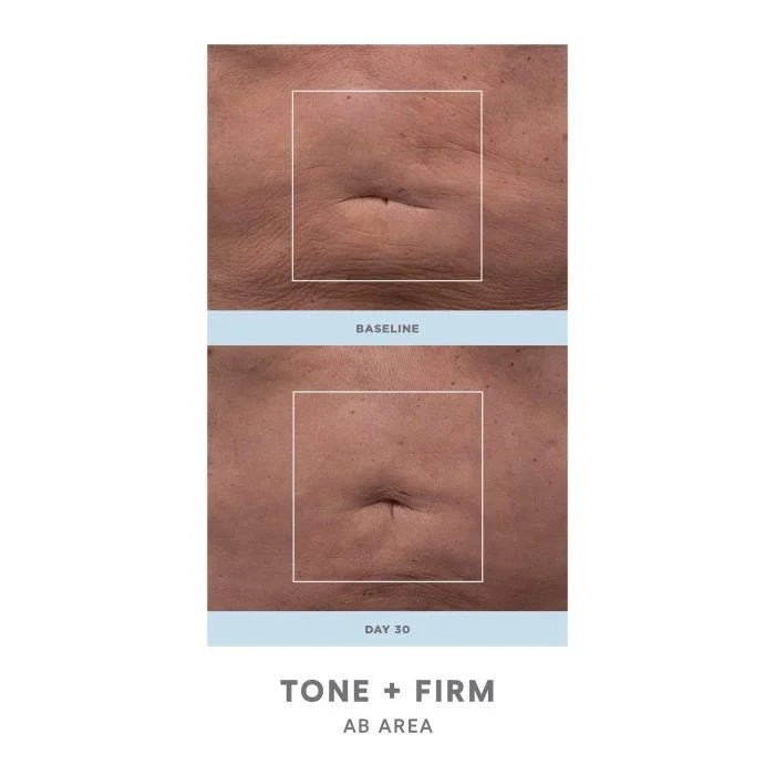 Bloomi - Forfait Summer Body Ritual