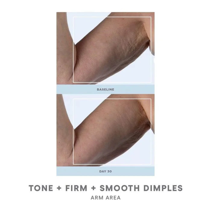 Bloomi - Forfait Summer Body Ritual
